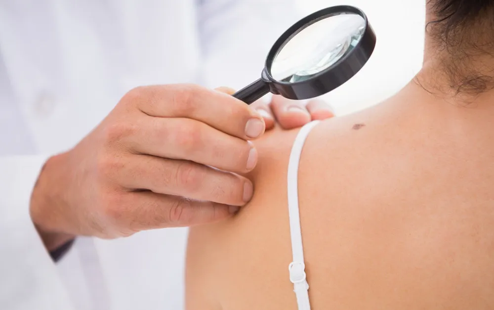 Talk Spot: How to Identify an ODD SPOT and Why It Matters for Skin Cancer Awareness